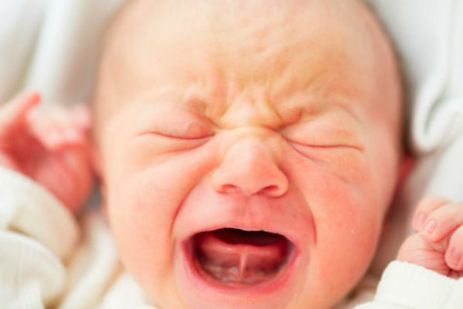 ¿Qué es la Anquiloglosia?