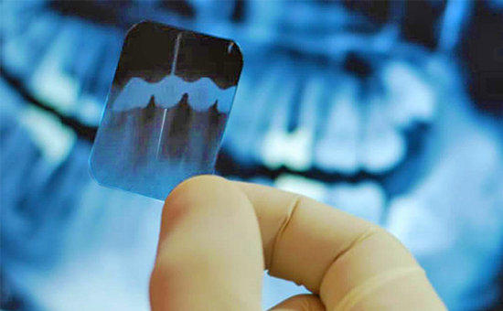 Periodoncia y endodoncia, ¿en qué se diferencian?