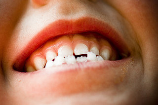¿Cuándo tengo que llevar a mi hijo al dentista?