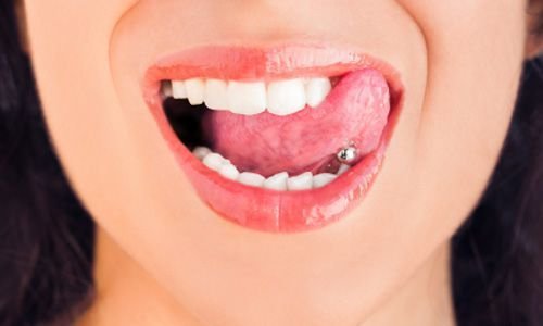 Piercing Bucal, una peligrosa moda para los dientes