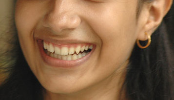 Reposición de piezas dentales