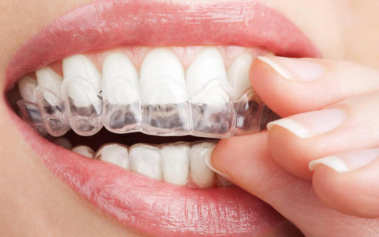 Razones para no blanquearse los dientes con remedios caseros